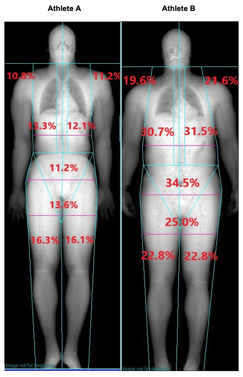 Body Composition – DEXASCANNEARME